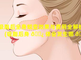 吸脂后全身蜕变效果与费用全解析(吸脂后身 🌿 体会发生哪 🐵 些事情变化)